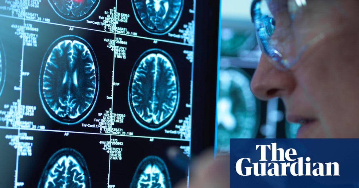Record numbers of people in England given dementia diagnosis in past year
