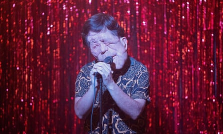 This image released by A24 shows Adam Pearson in a scene from “A Different Man.” (Matt Infante/A24 via AP)