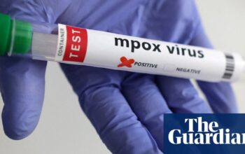 First known US case of person infected with new mpox strain reported