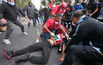 Photographer in coma after Argentina police hit pensioner protest hard