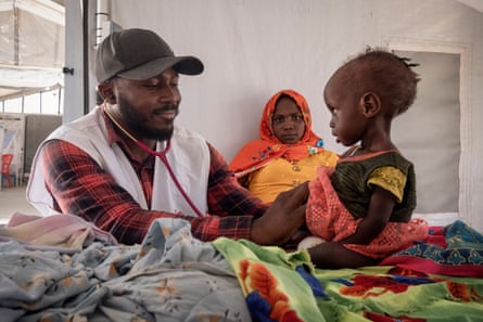 Child suffering from malnutrition is treated at an MSF clinic in Metche Camp, Chad