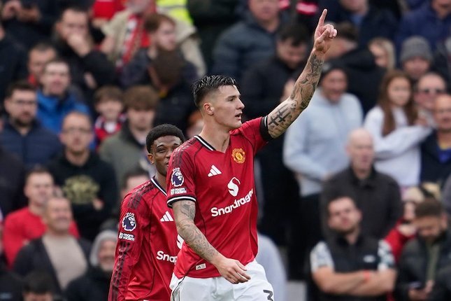 Liverpool vs Manchester United